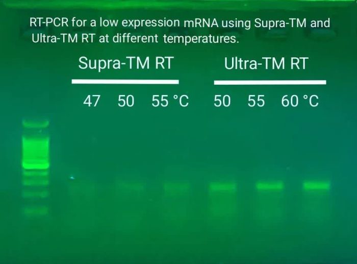 مقایسه دو آنزیم Ultra & Supra RT