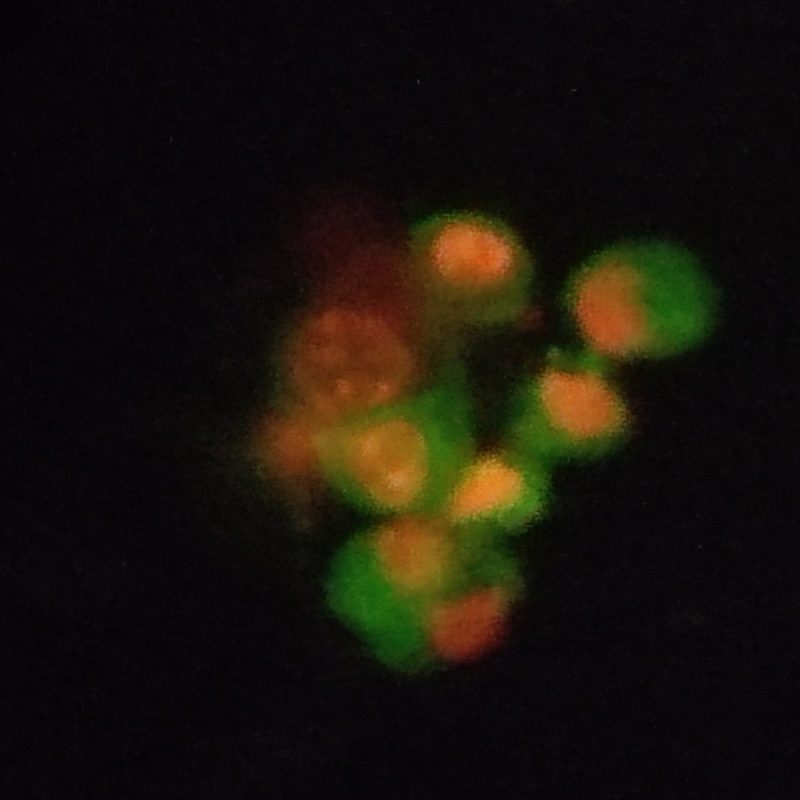 Apoptosis